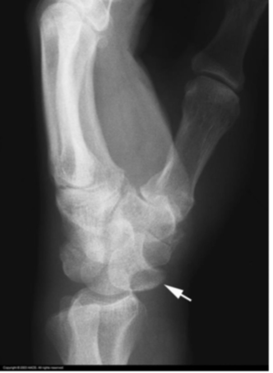 <p>What is the issue?</p>