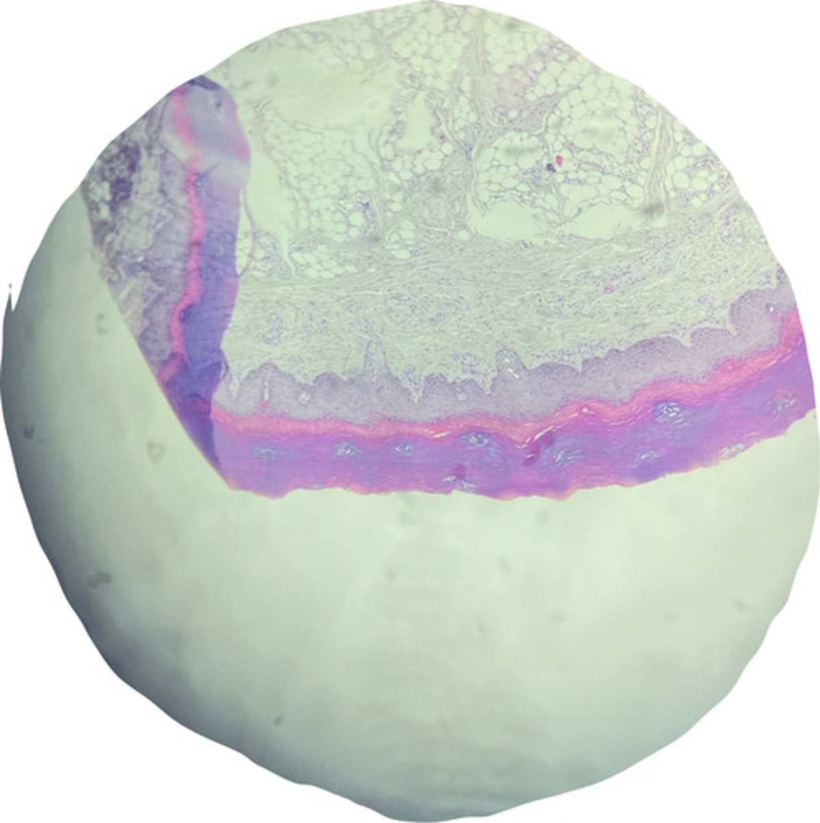 <p>this is a sample of a foot pad of a dog. what epithelial lining is present?</p>