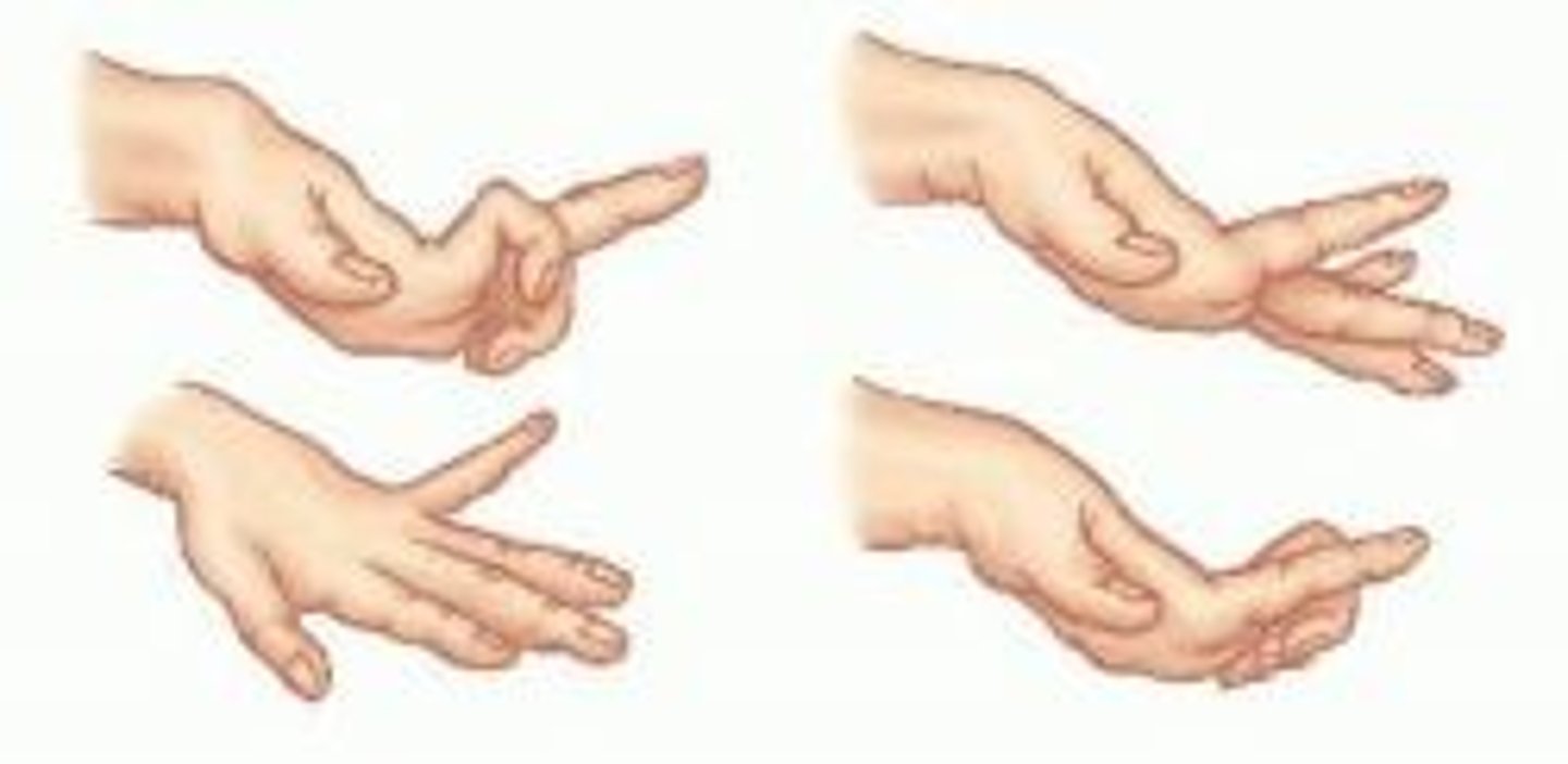 <p>Bizarre, slow, twisting, writhing movement, resembling a snake or worm</p>