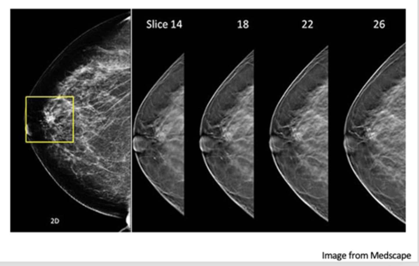 <p>addition of 3D technology allows images to be viewed in multiple planes/layers</p>