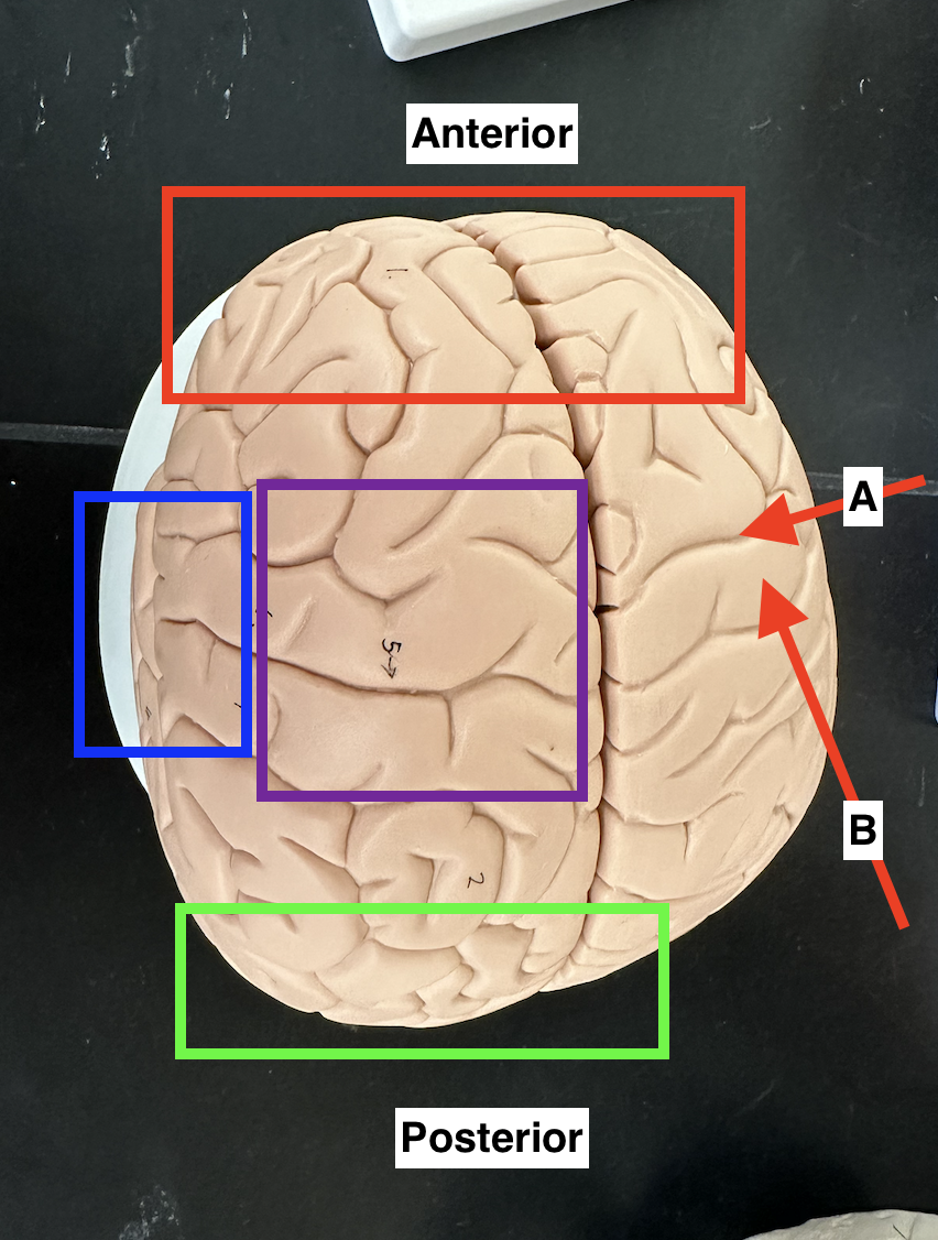 <p>Name the lobe in the red box.</p>