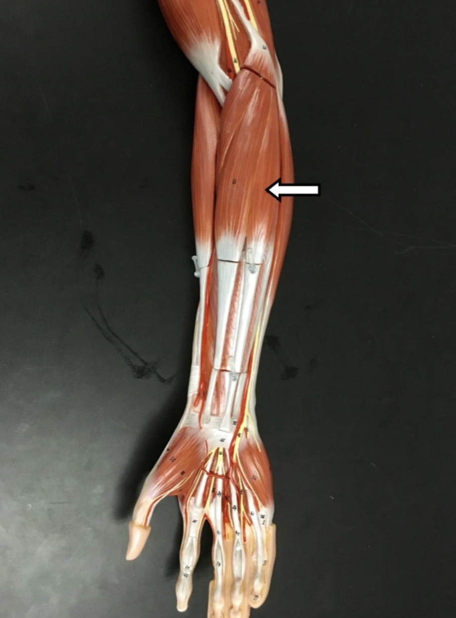 <p><span>Name the muscle labeled with the white arrow below.</span></p>