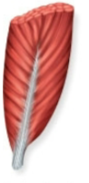 <p>Name this fascicle arrangement:</p>