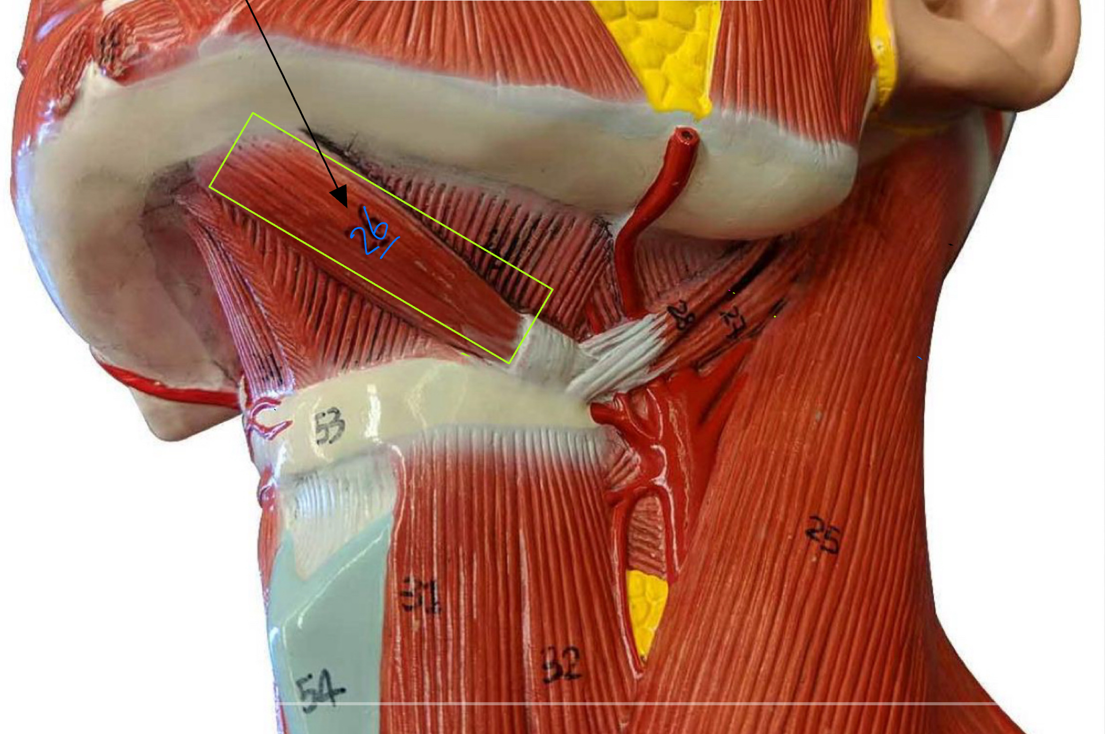 <p>what type of muscle is this (altay model )</p>
