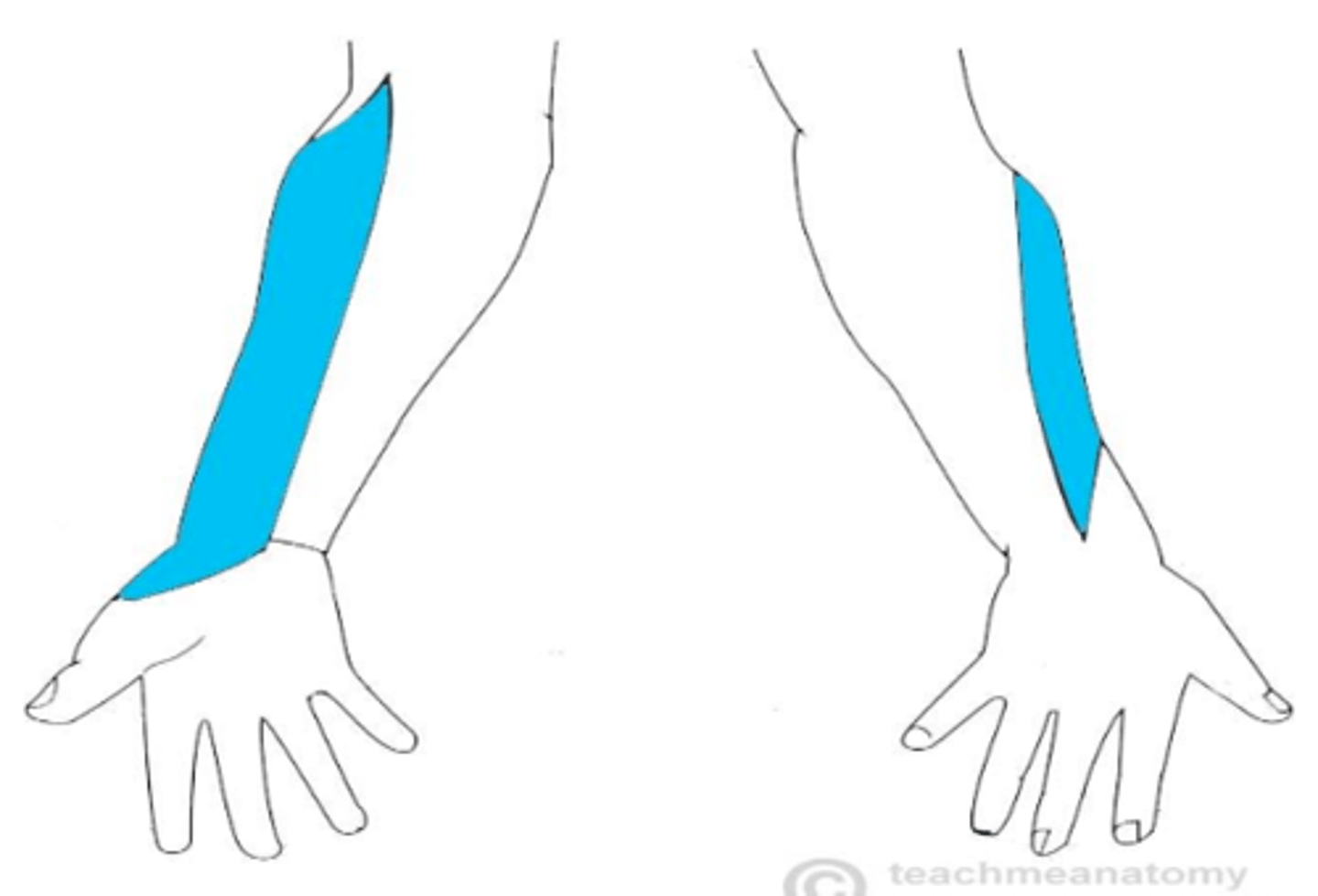 <p>anterolateral forearm</p>