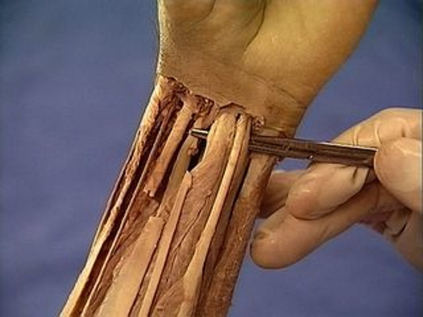 <p>a skeletal muscle whose contraction bends a joint</p>