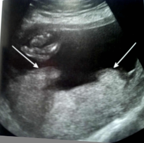 <p>What are the arrows pointing to?</p>