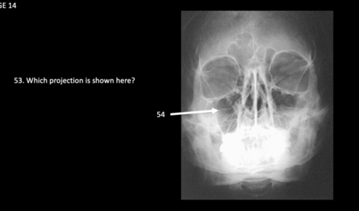 <p>What is 54?</p>