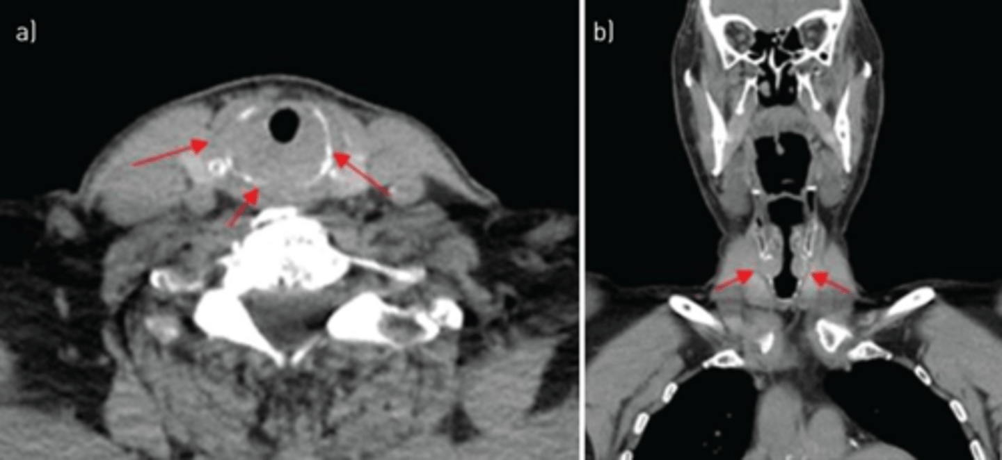<p>Label pathology in the two images below</p>