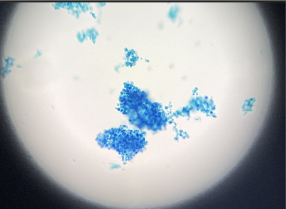 Chlamydomonas 