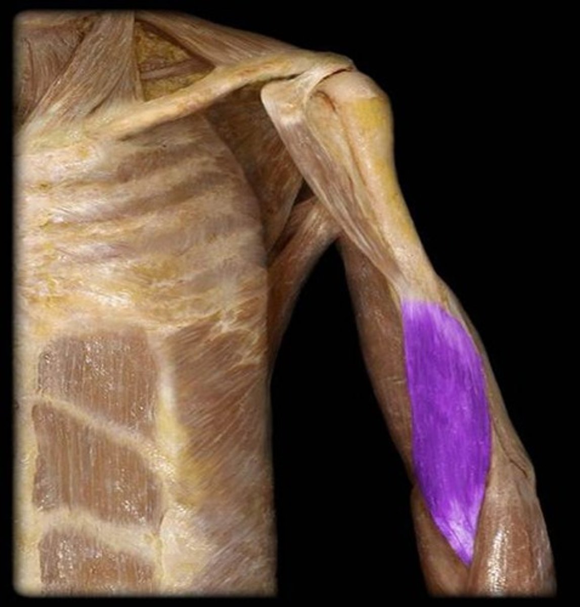 <p>What is the name of this muscle, highlighted in purple?</p>