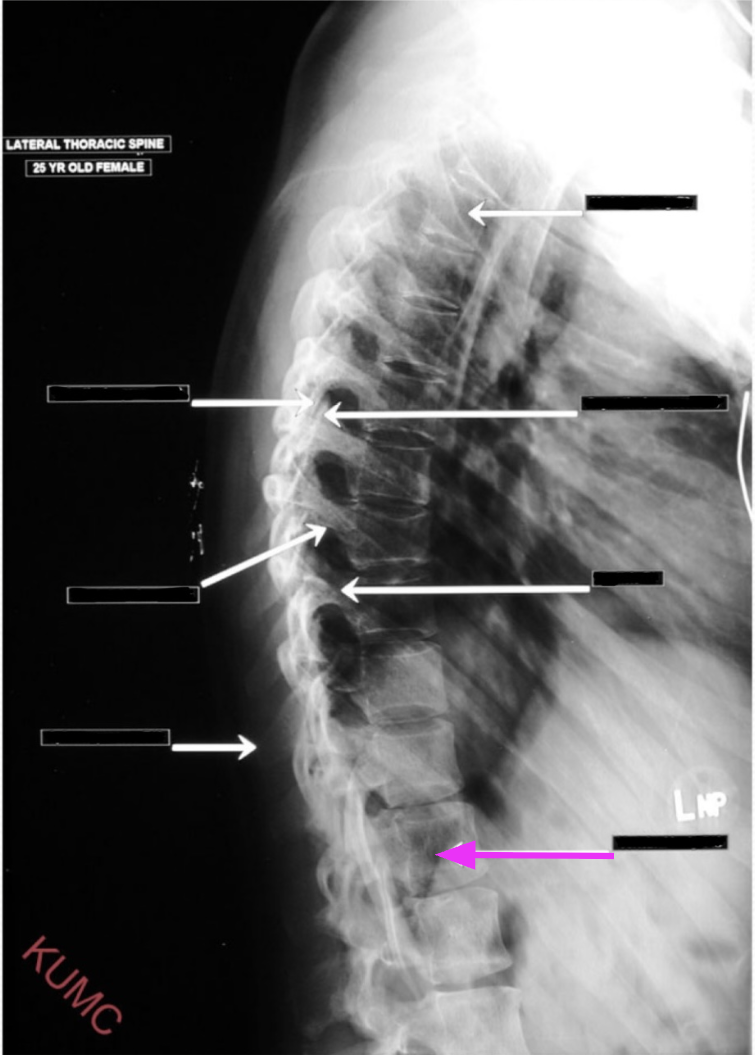 <p>What structure is referenced by the arrow highlighted in pink?</p>