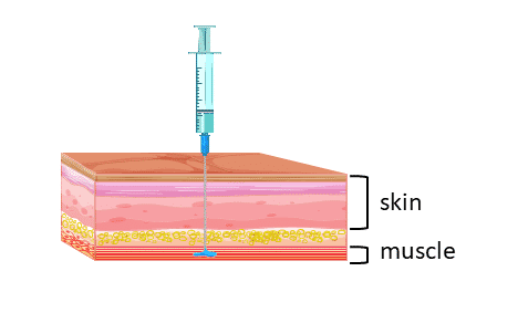 <ul><li><p>Drugs with a large volume</p></li><li><p>Rate of Absorption is dependent on Blood Volume.</p></li></ul><p></p>