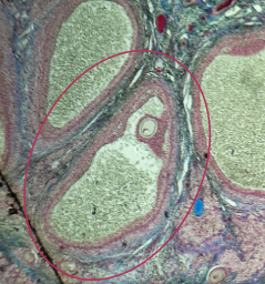 <p>What is the fate of this structure?</p>