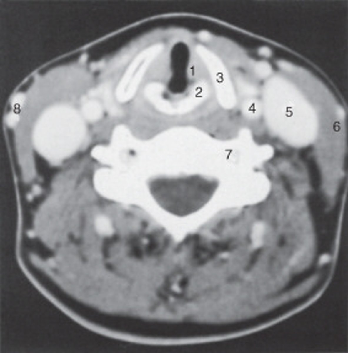 <p>The common carotid artery is labeled:</p>