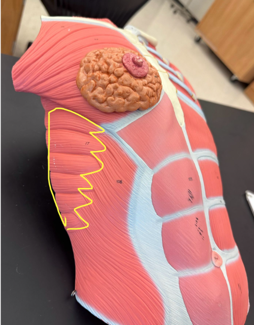 <p>What muscle is the yellow line indicating?</p>