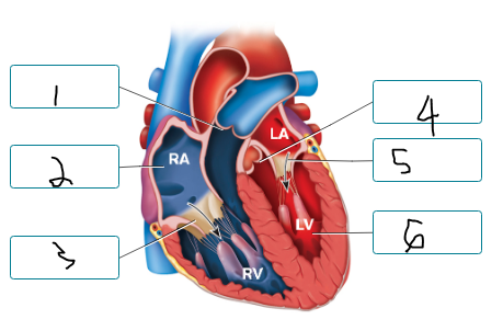 <p>This figure illustrates the heart during ventricular diastole and atrial systole. Label the positioning of the valve cusps during this phase of the cardiac cycle.</p><p><span style="font-size: inherit; font-family: inherit"><br></span></p>