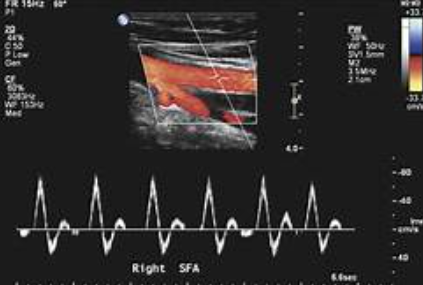 <p>Which type of waveform is this?</p>