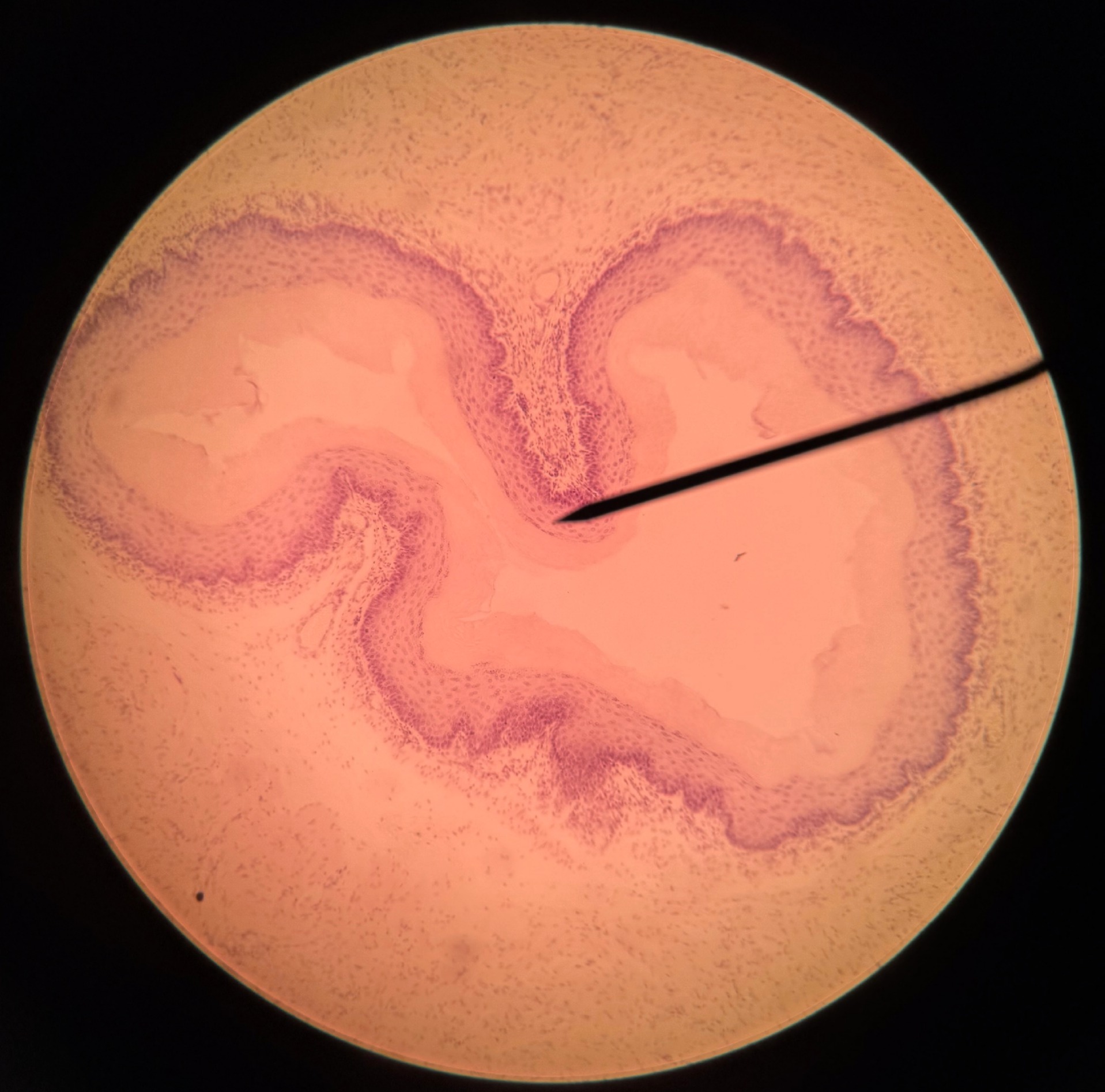 <p>Organ?</p><p>Structure found in submucosa?</p>