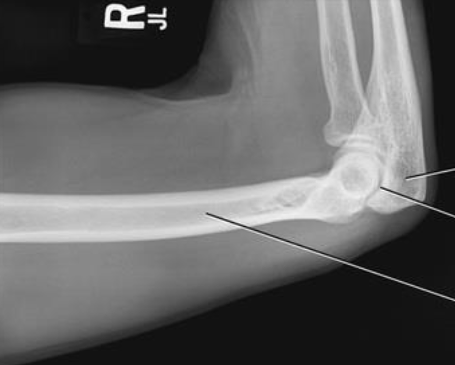 <p>what is this projection&nbsp;</p>