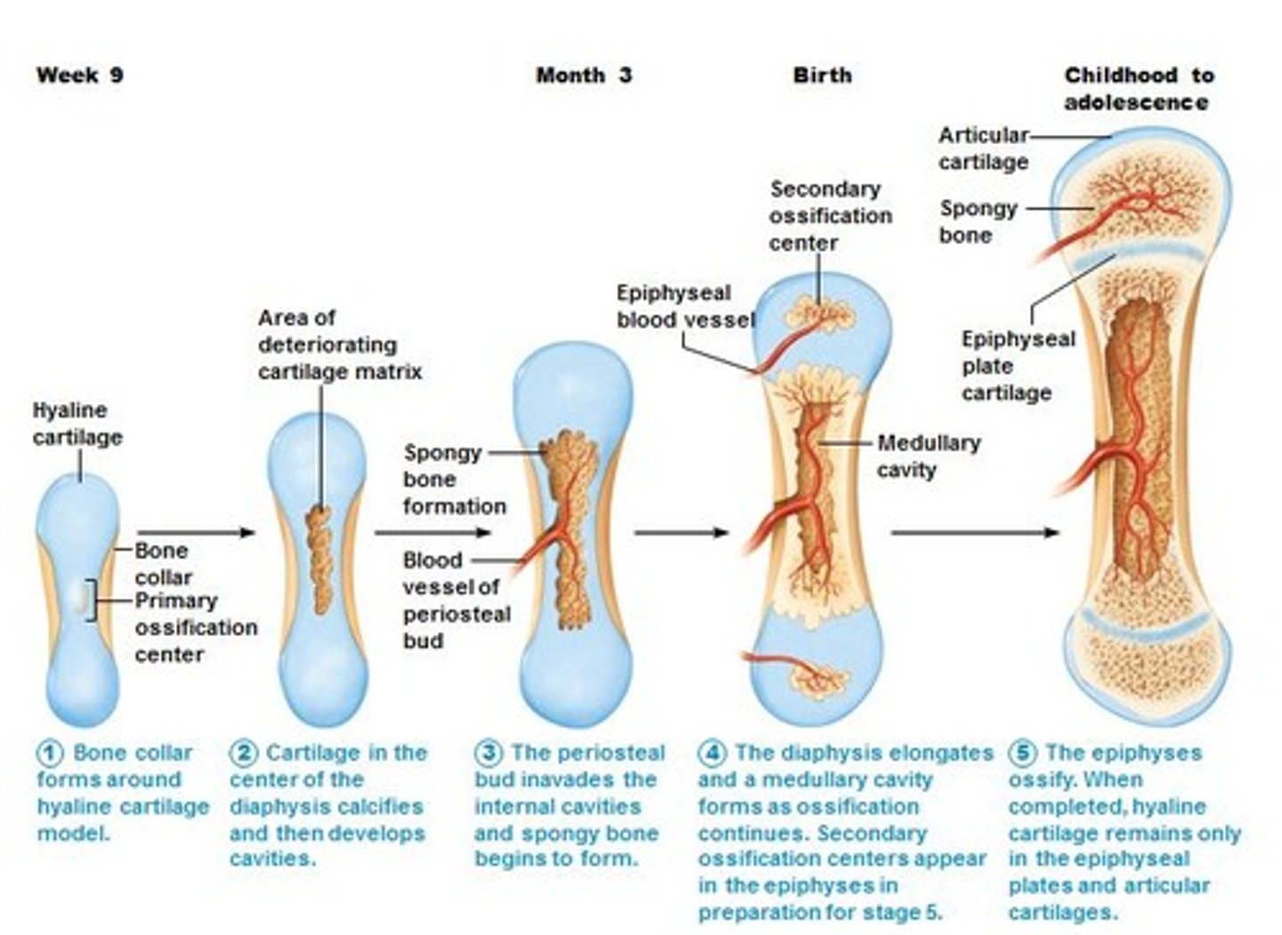<p>-Most of the bones of the skeleton form this way</p><p>1) Skeleton begins as Hyaline Cartilage model</p><p>2) Bone replaces cartilage</p><p>3) Epiphyseal (growth) plates ossify eventually</p>