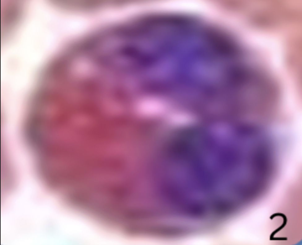 <p><span style="color: purple;"><strong><em><span>Formed Element:</span></em></strong><em><span> </span></em></span><strong>Eosinophil (leukocyte)</strong></p>