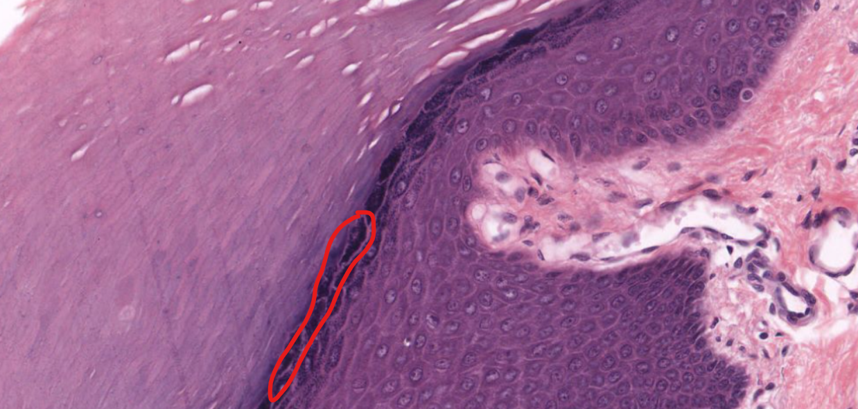 term image