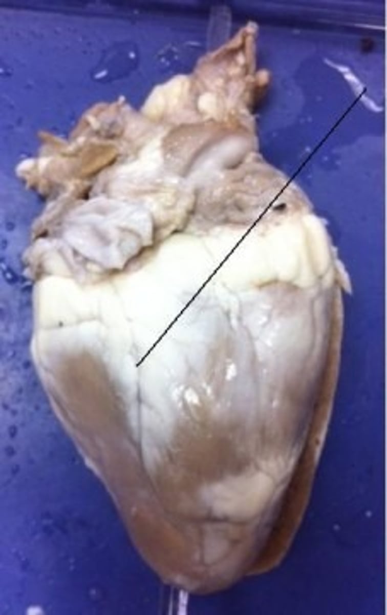 <p>Identify the structure.</p>