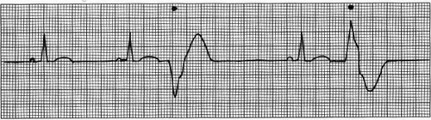 knowt flashcard image