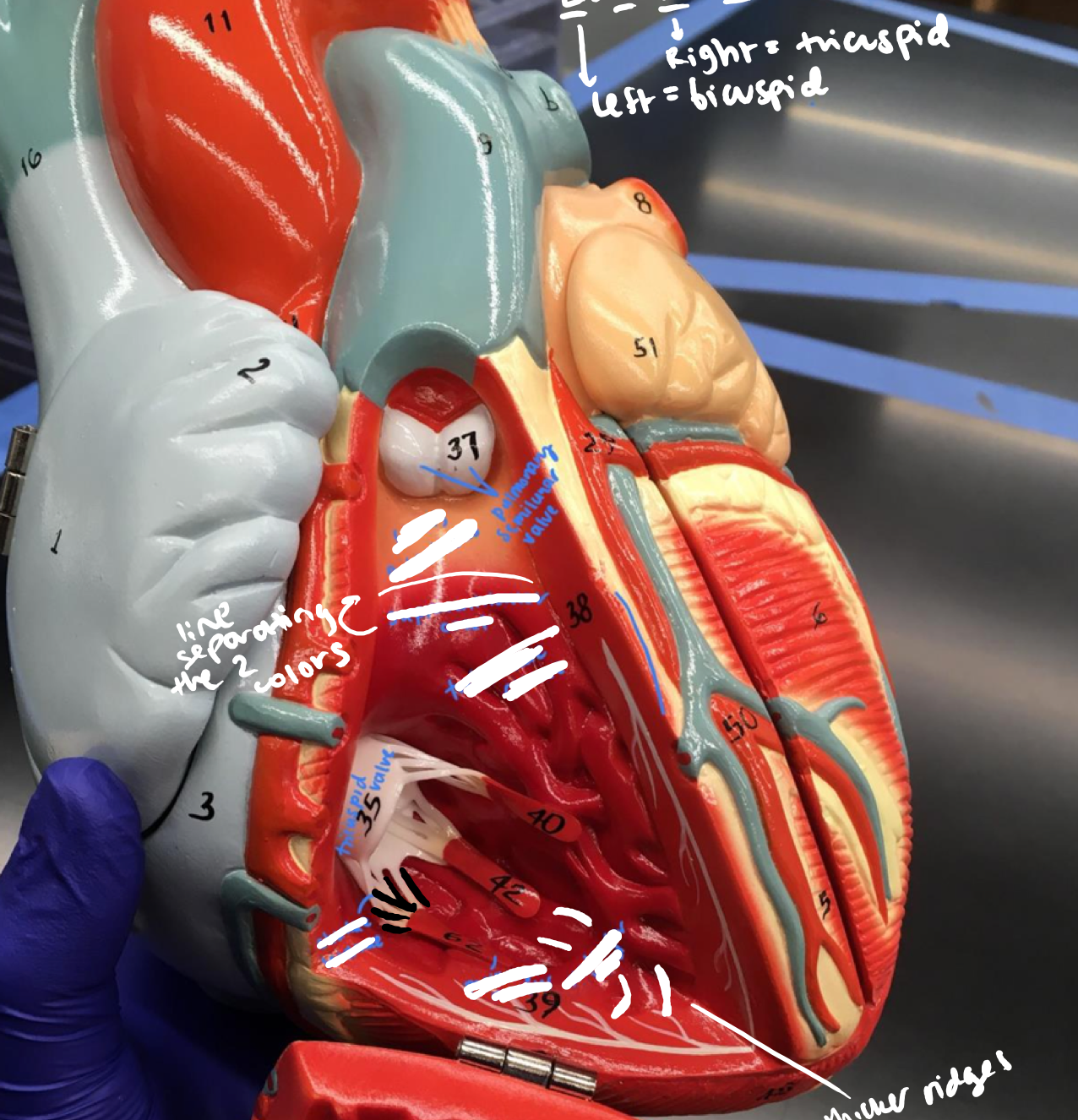 <p>The white connections from the papillary muscles to the valve under the pulmonary semilunar valve</p>