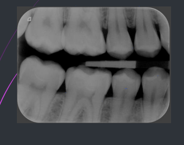 <p>what type of radiograph is this?</p>