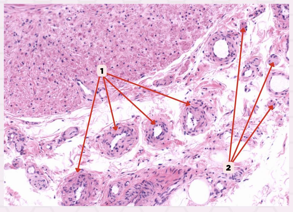 <p>Identify the structure labeled as 2.</p>