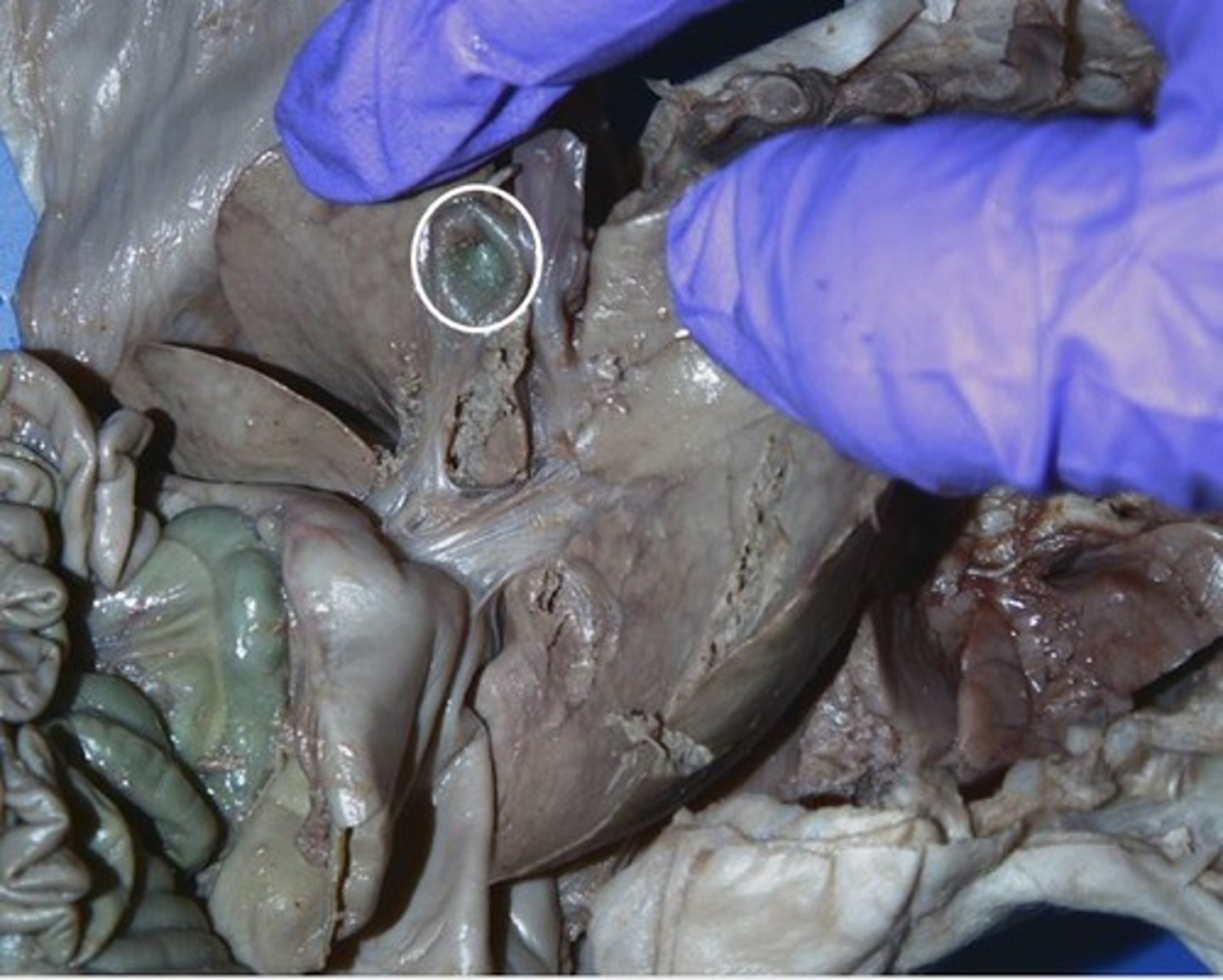 <p>the organ that stores bile after it is produced by the liver</p>