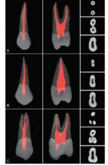 <p>kidney shaped, figure 8, hourglass</p>