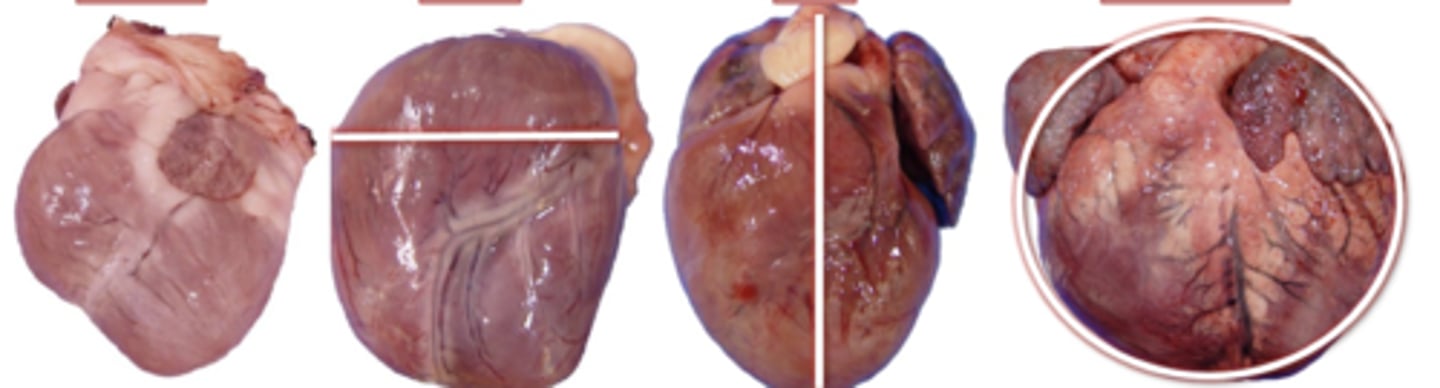 <p>What gross change is apparent due to left cardiac hypertrophy?</p>
