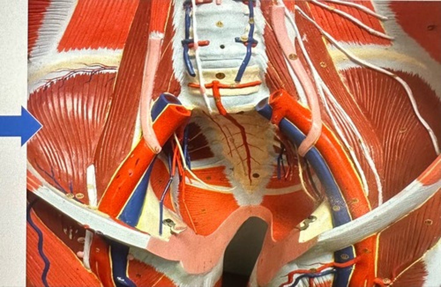 <p>Iliacus</p>