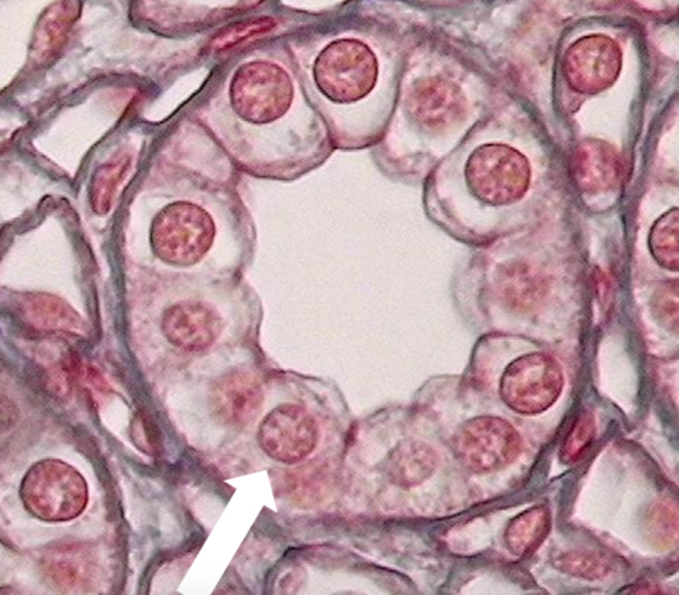 <p>classify this type of epithelial lining</p>