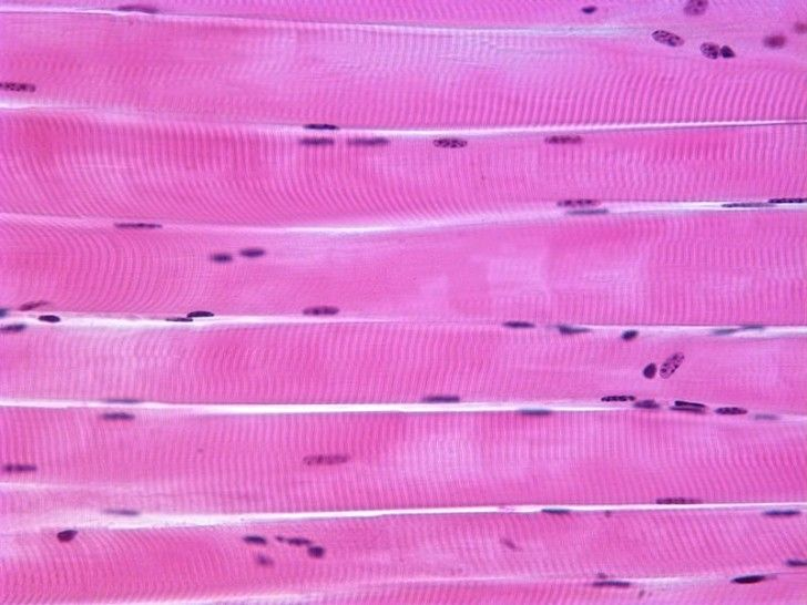 <ul><li><p><span style="background-color: transparent;">Striated&nbsp;</span></p></li><li><p><span style="background-color: transparent;">Attached to bones (voluntary movement, posture, and stabilization)&nbsp;</span></p></li><li><p><span style="background-color: transparent;">Innervated by somatic motor neurons that stimulates contractions&nbsp;</span></p></li></ul><p></p>