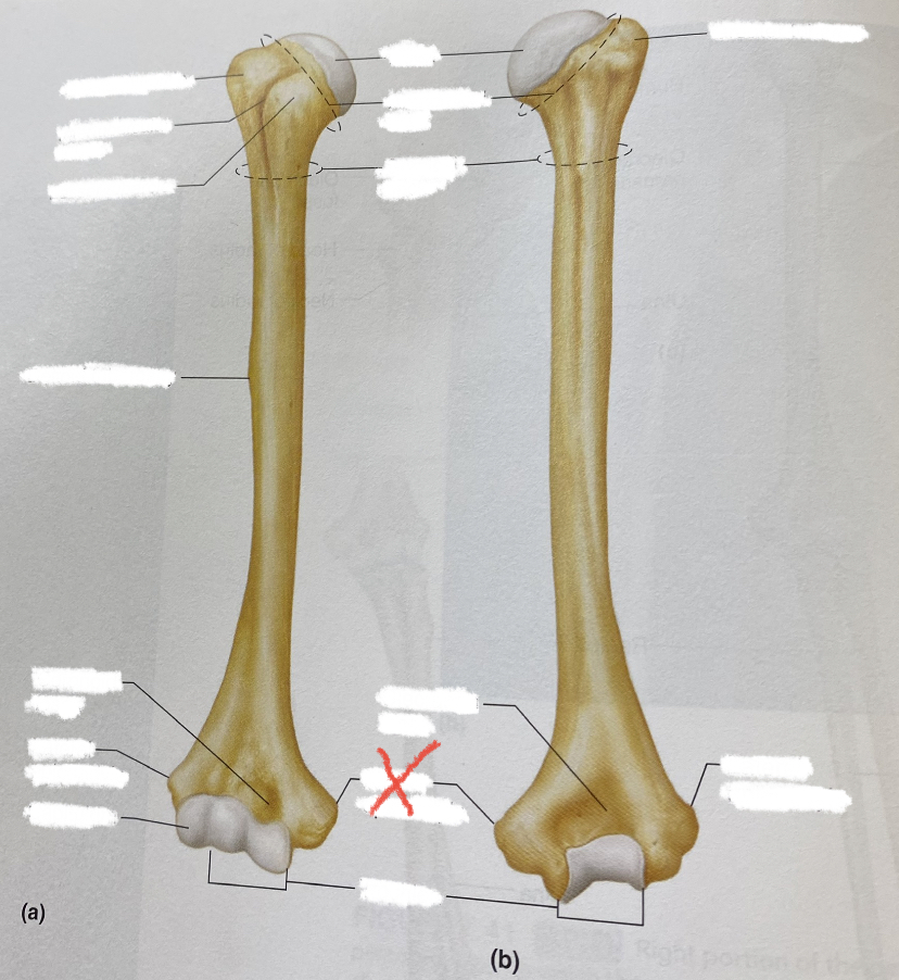 common fractures here