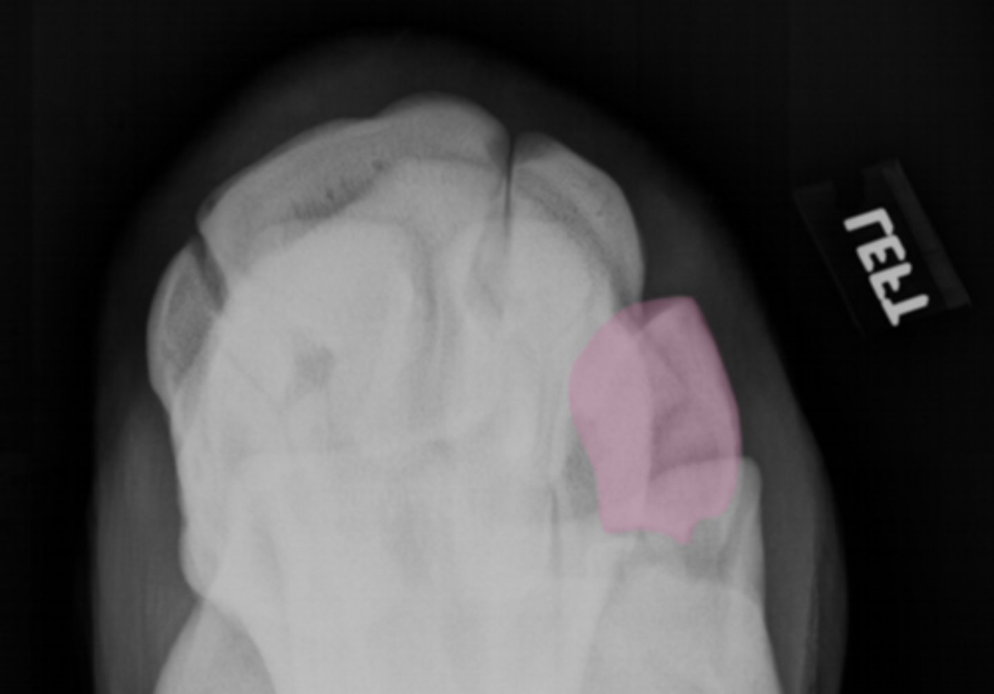<p>What bone is highlighted?</p>