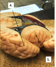 <p>What lobe is #5?</p>