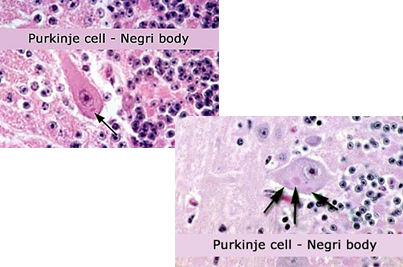 <ul><li><p><strong>History of exposure</strong> (bite or contact with infected animal)</p></li><li><p><strong>Negri bodies</strong> found in Purkinje cells of the brain (post-mortem)</p></li><li><p>RT-PCR or immunofluorescent staining (post-mortem)</p></li></ul><p></p>
