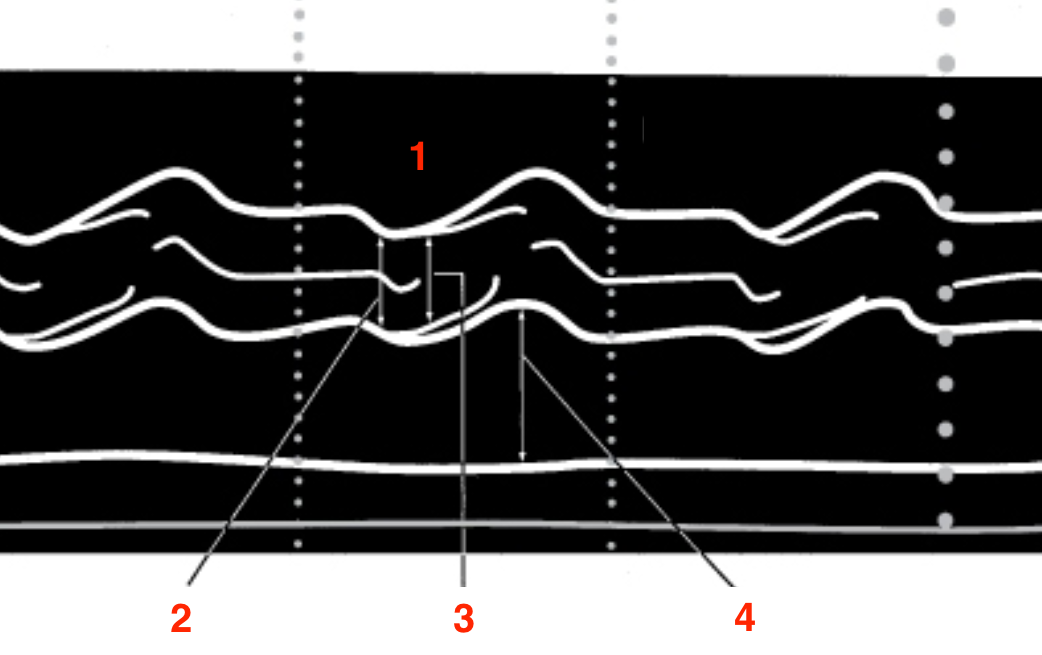 <p>Identify this image. </p>
