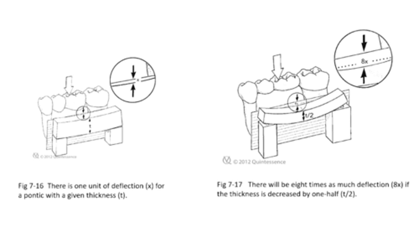 <p>There is _________ times deflection if pontic thickness is decreased by 1/2</p><p>a) 2x</p><p>b) 4x</p><p>c) 8x</p><p>d) 16x</p><p>e) 27x</p>