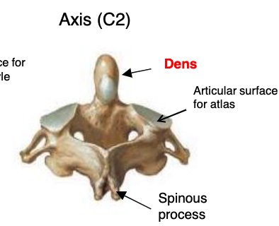 <p>dens</p>
