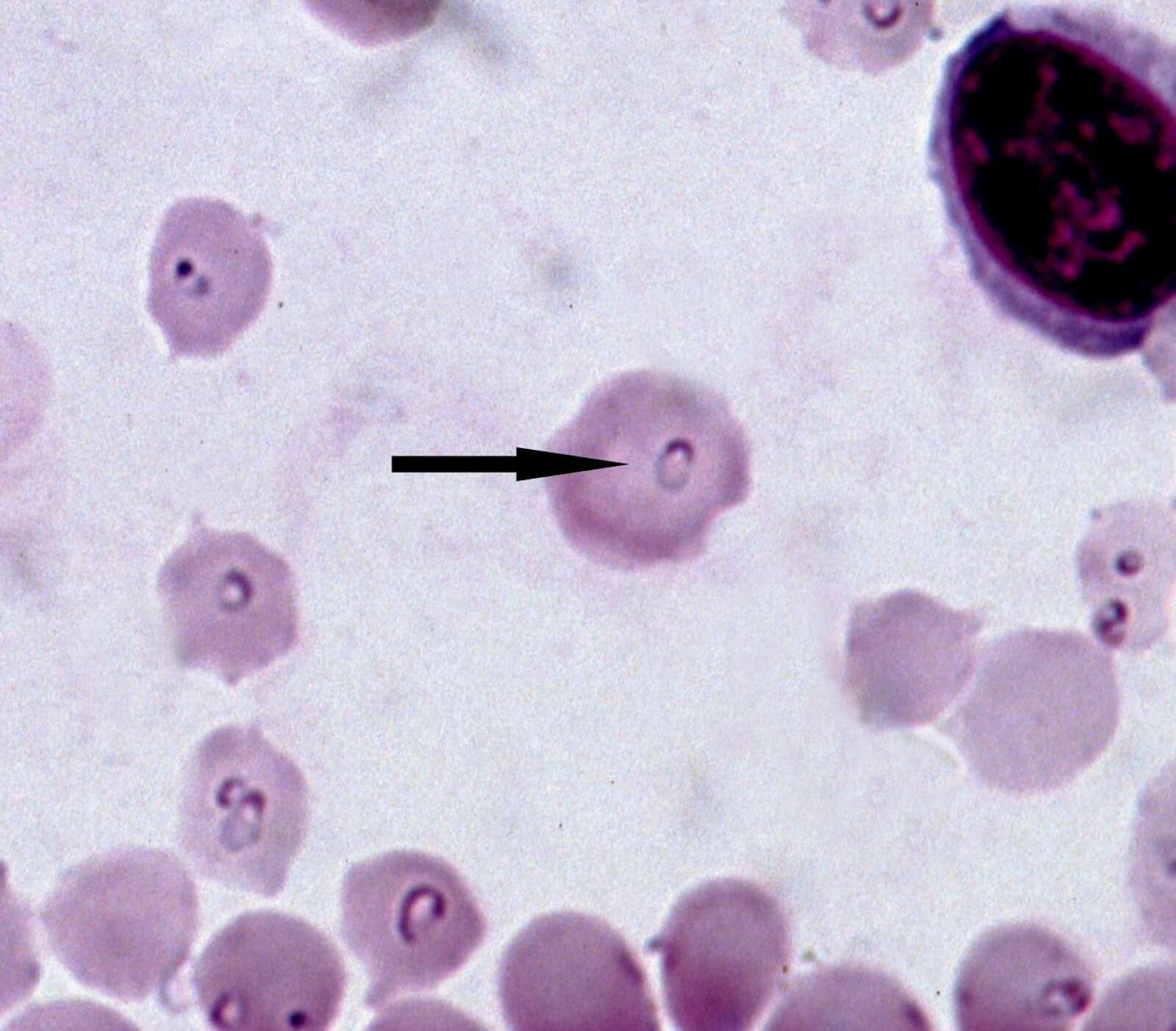 <p>What is this parasite</p>