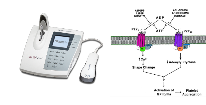 <p>optical detection system to assess <span style="color: red">P2Y12 receptor inhibition</span>, reported in P2Y12 reaction units (PRUs)</p><ul><li><p><span style="color: red">P2Y12 receptor: key in plt aggregation in response to ADP</span></p></li><li><p>measures extent of ADP-induced plt clumping of fibrinogen-coated beads (plt aggregation)</p></li><li><p><strong>can monitor anti-plt therapy (ie Plavix)</strong></p></li></ul><p></p>