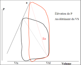 <ul><li><p class=""><strong>Différence de volume réduite</strong>&nbsp;→&nbsp;<strong>Volume éjecté plus petit</strong></p></li><li><p class=""><strong>Pression à l’éjection augmente</strong></p></li></ul><p></p>