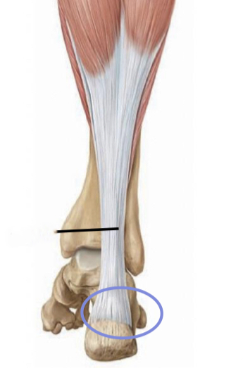 <p>calcaneus (via calcaneal tendon)</p>