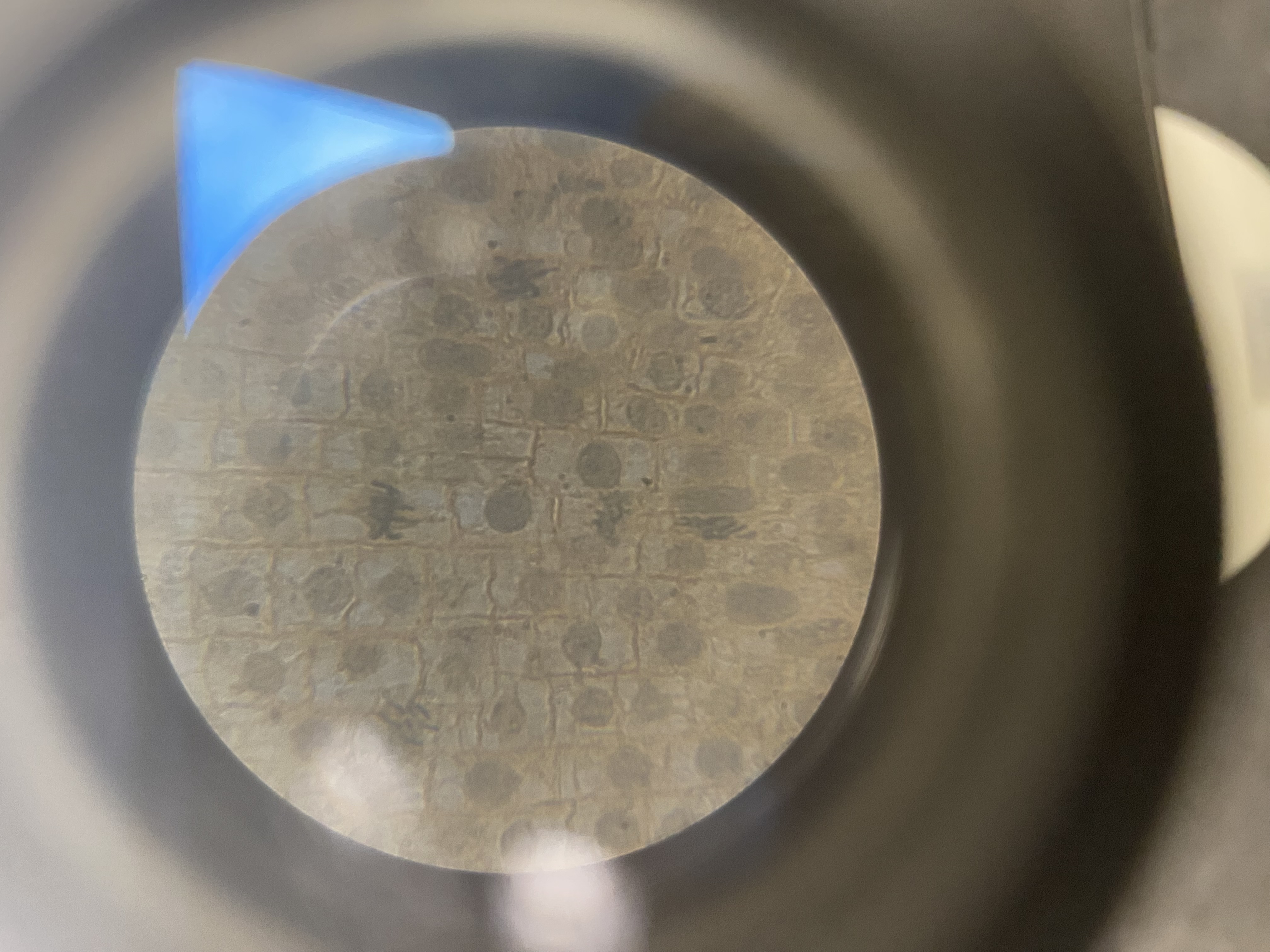 <p>400x</p>